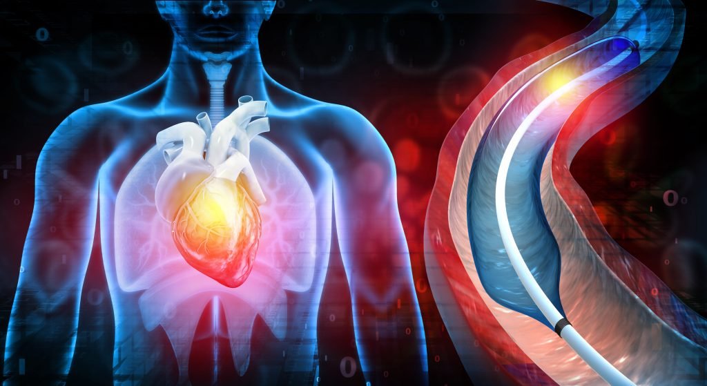 interventional cardiology