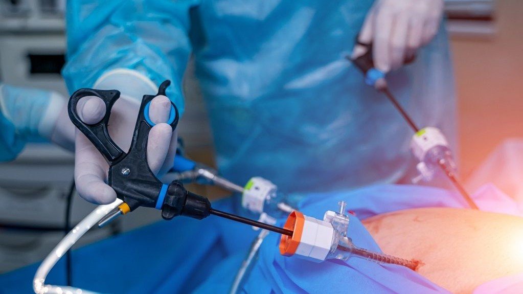 laparoscopy