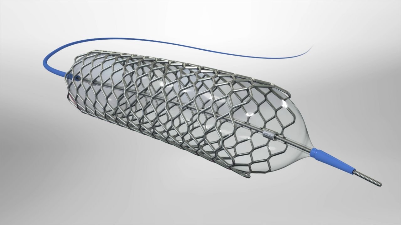 stent