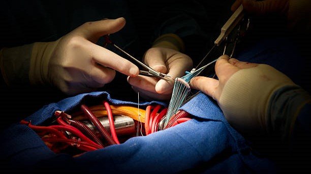 istockphoto-154954606-612x612